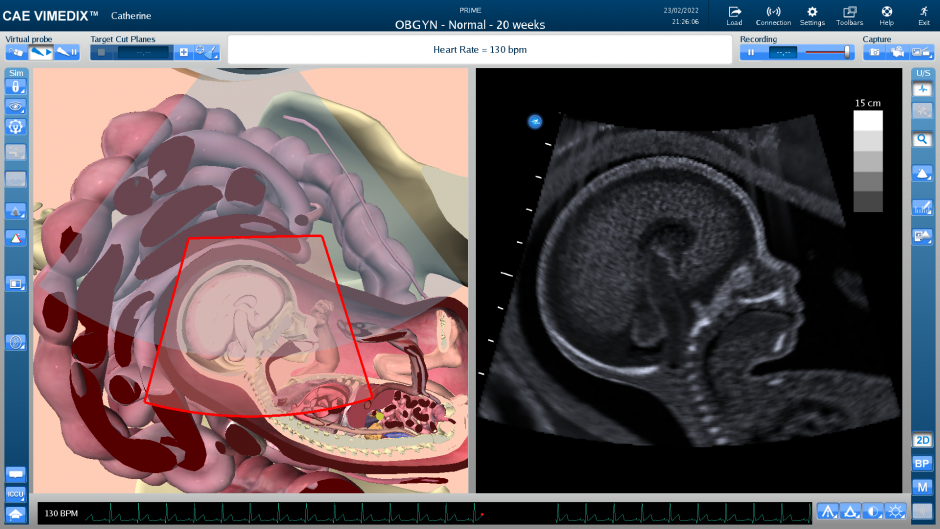 screenshot from the screen of an ultrasound simulator