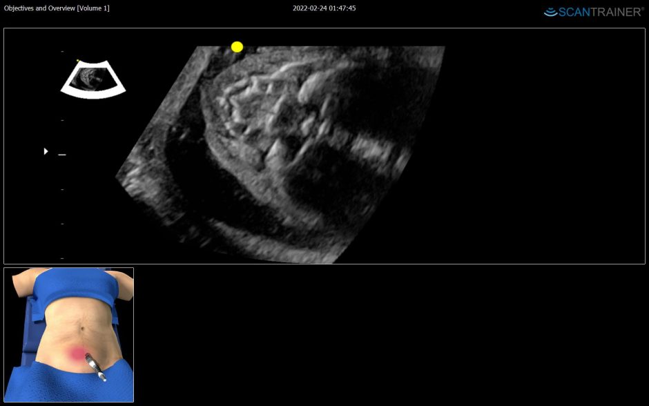 screenshot of ultrasound simulator